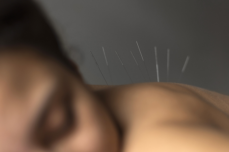 Méthode acupuncture dans la médecine chinoise